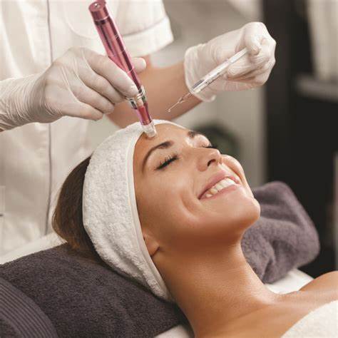 microneedling